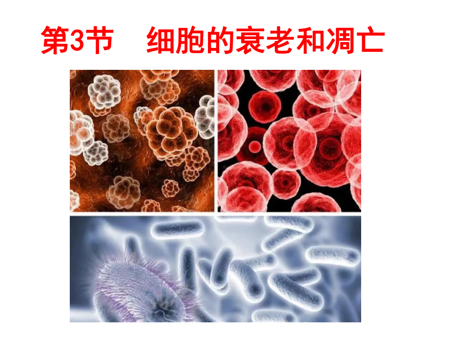 必修1生物新教材人教 6.3细胞的衰老和死亡.ppt_第3页