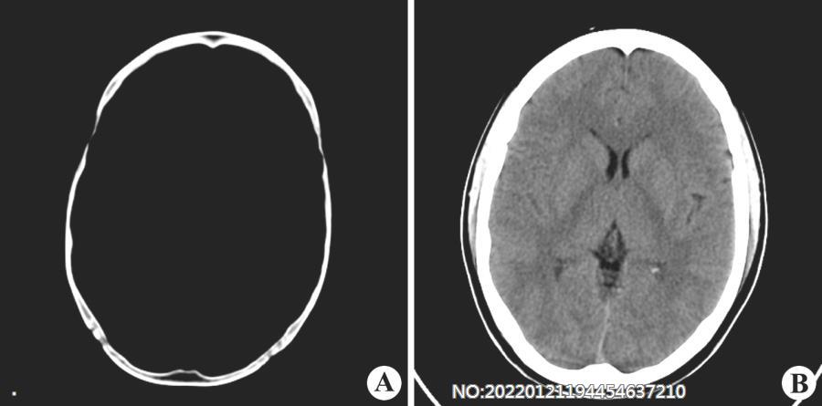 图8-4头颅骨CT检查.jpg
