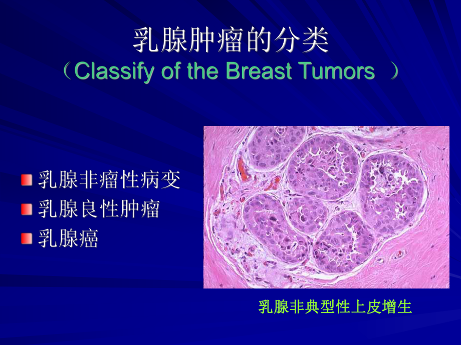 泌尿生殖课件：3-2乳腺.pptx_第2页