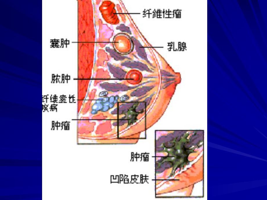 泌尿生殖课件：3-2乳腺.pptx_第3页