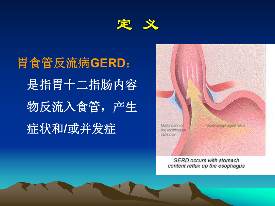 内科学课件：胃食管反流病-临床.ppt_第3页