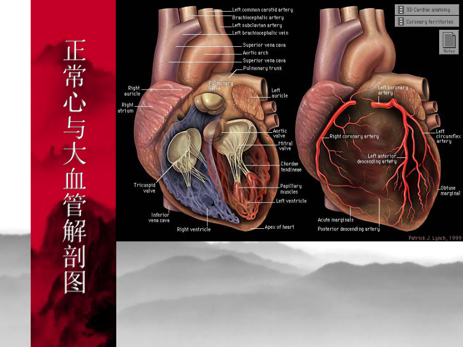 影像学课件：循环系统X线诊断(16).ppt_第3页