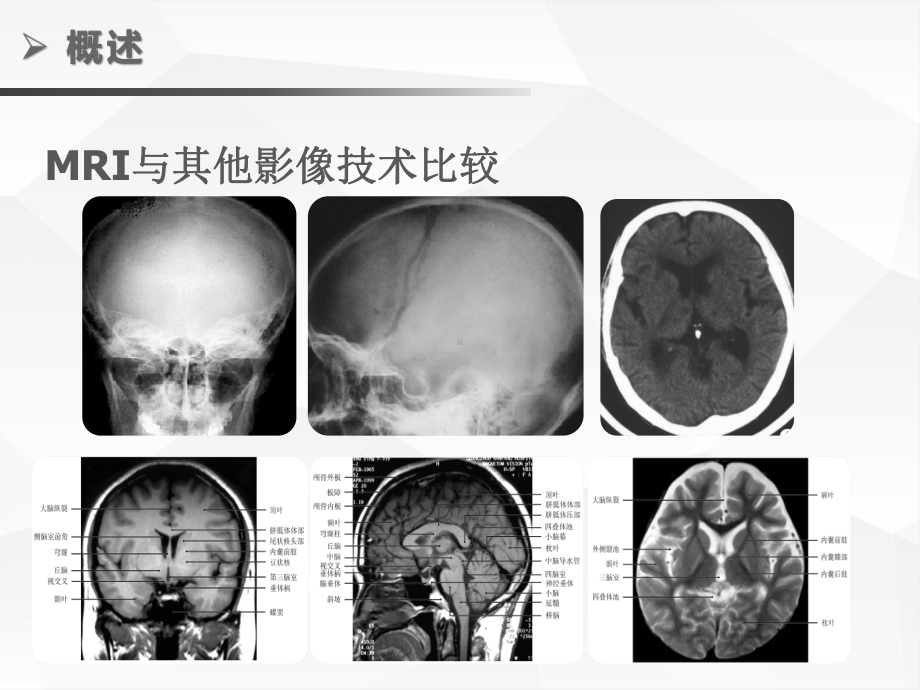 影像学课件：MR总论.pptx_第3页