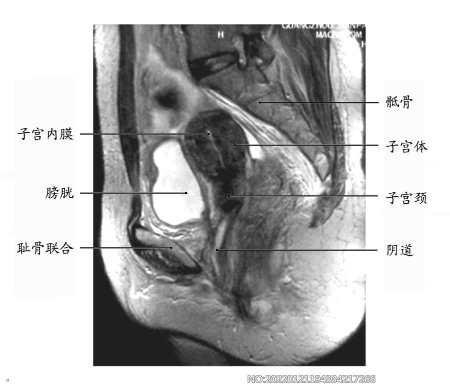 图7-7正常女性盆腔MRI.jpg