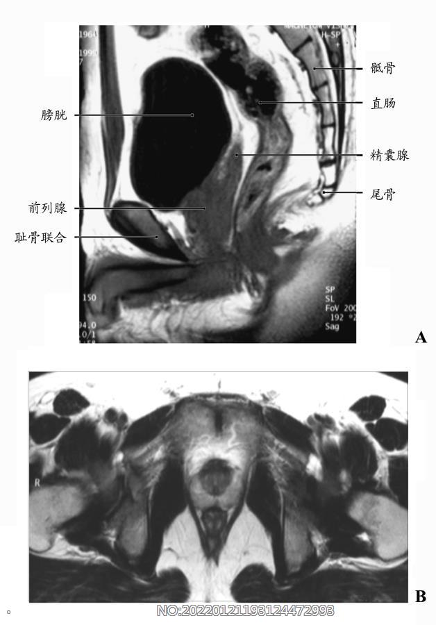 图7-10正常男性盆腔MRI.jpg