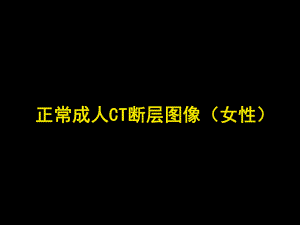 影像学课件：正常 - CT.ppt