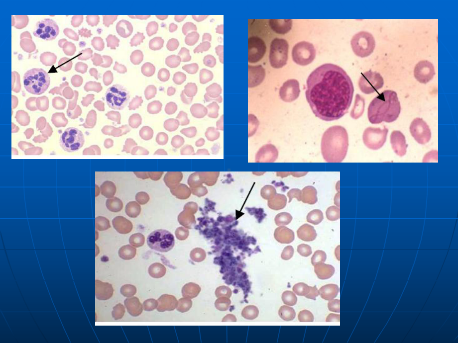 内科学课件：第六篇.血液系统疾病2015ppt.ppt_第3页