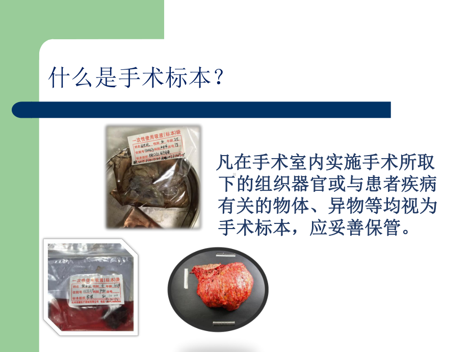 手术室标本管理.ppt_第3页