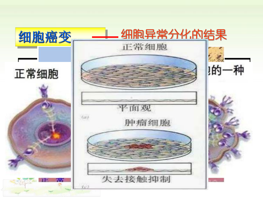 4.3细胞癌变、衰老和凋亡ppt课件-（新教材）2019新浙科版高中生物必修一.pptx_第2页