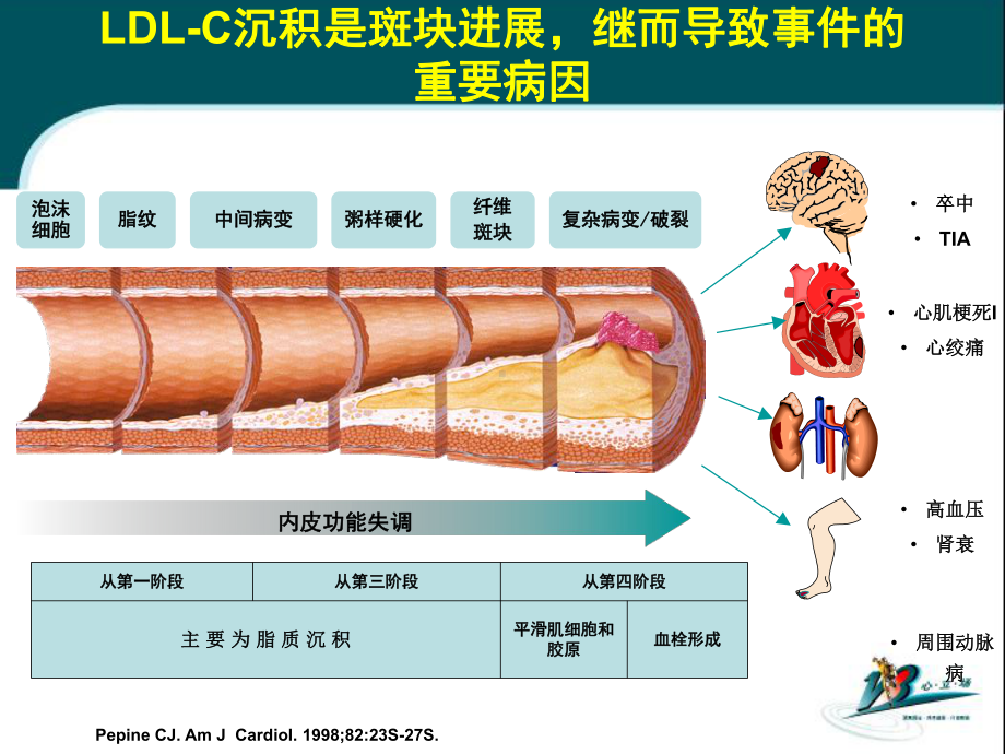 他汀抗动脉粥样硬化的进展改动版.ppt_第3页