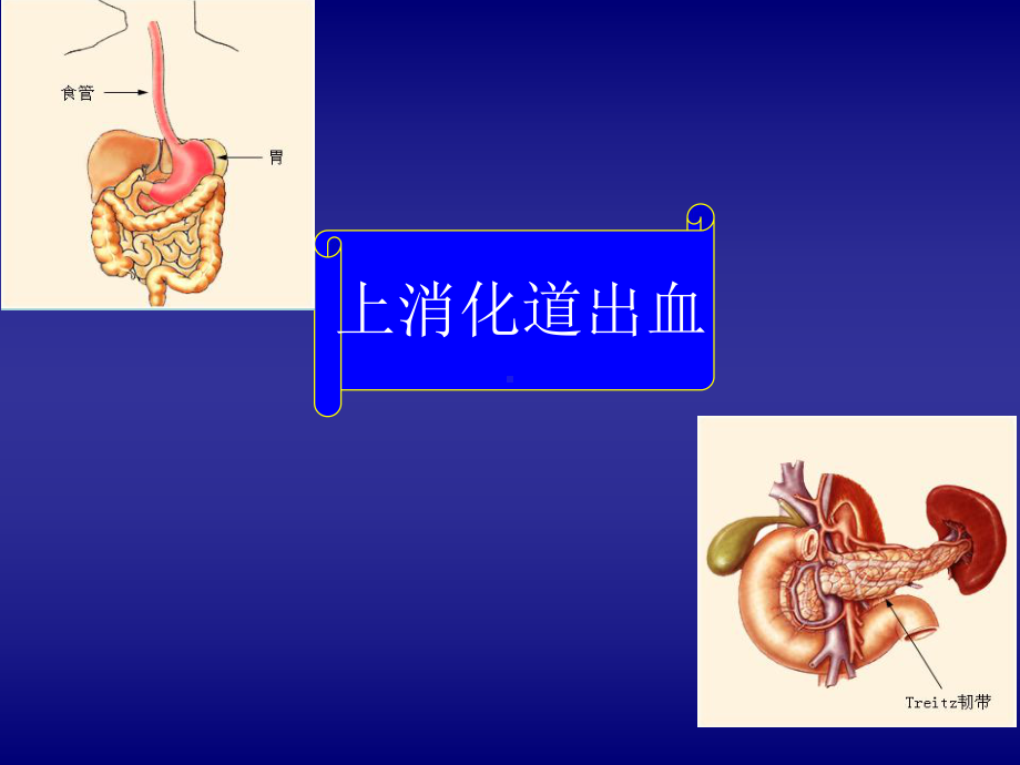 内科一课件：消化道出血.ppt_第3页