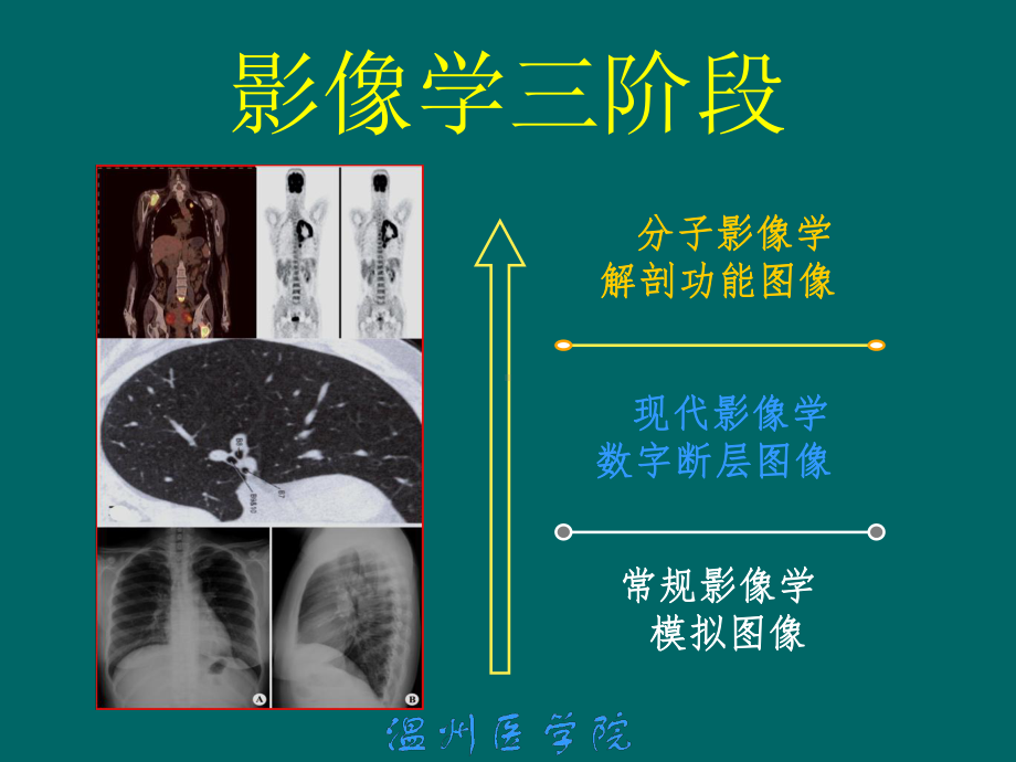 （核医学）肿瘤显像（18F-FDG）.ppt_第2页