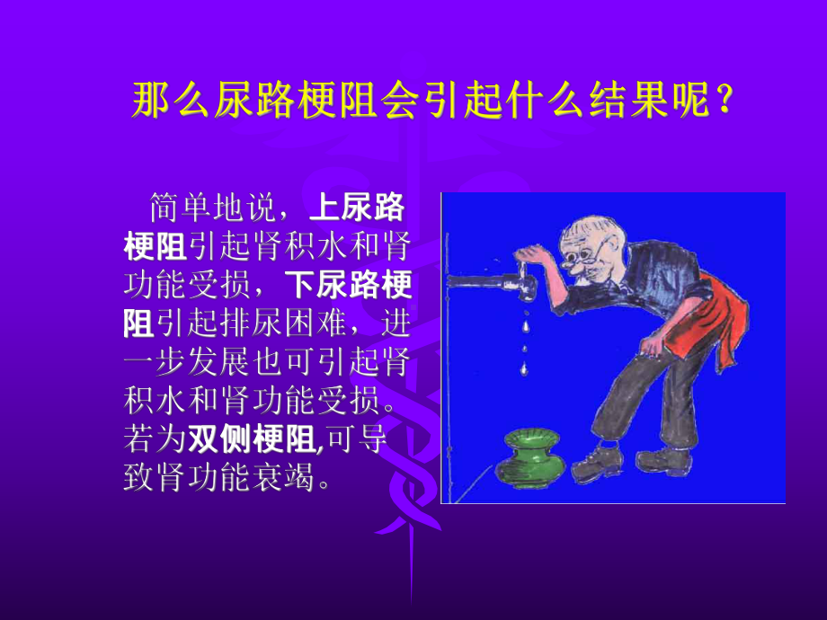 外科一课件：梗阻2016.ppt_第3页