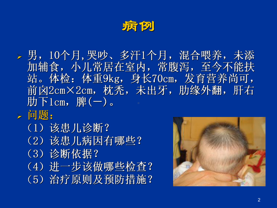 儿科课件：郑俊虎-维生素D缺乏性佝偻病.ppt_第2页