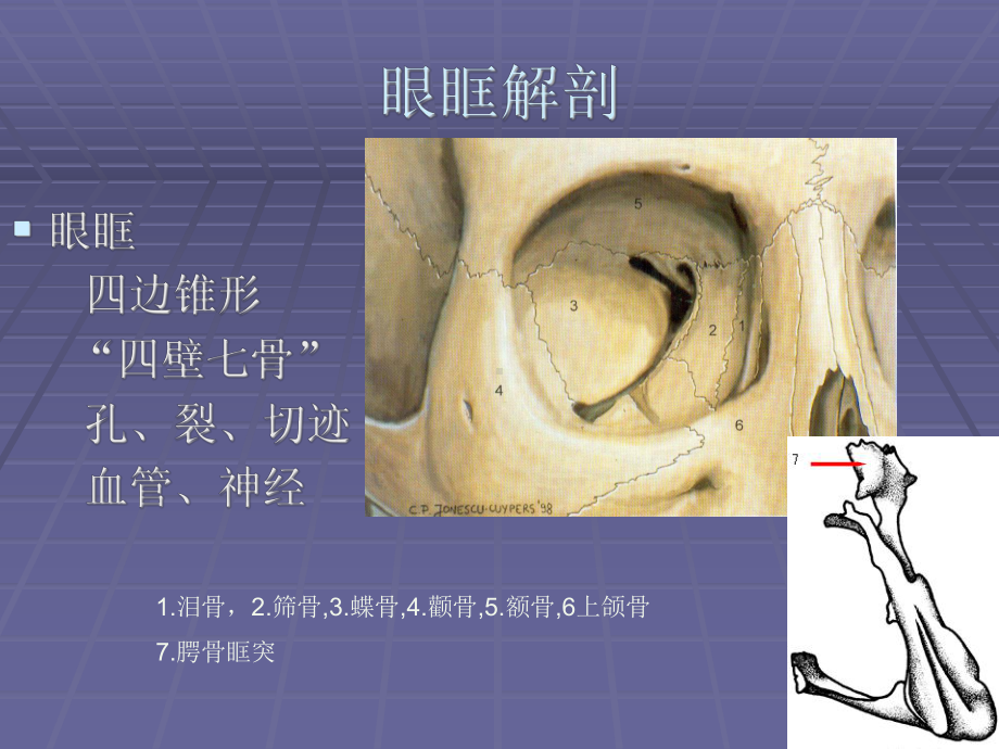 眼科学课件：眼眶病.ppt_第3页