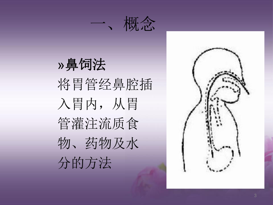 鼻饲法操作ppt课件.ppt_第3页