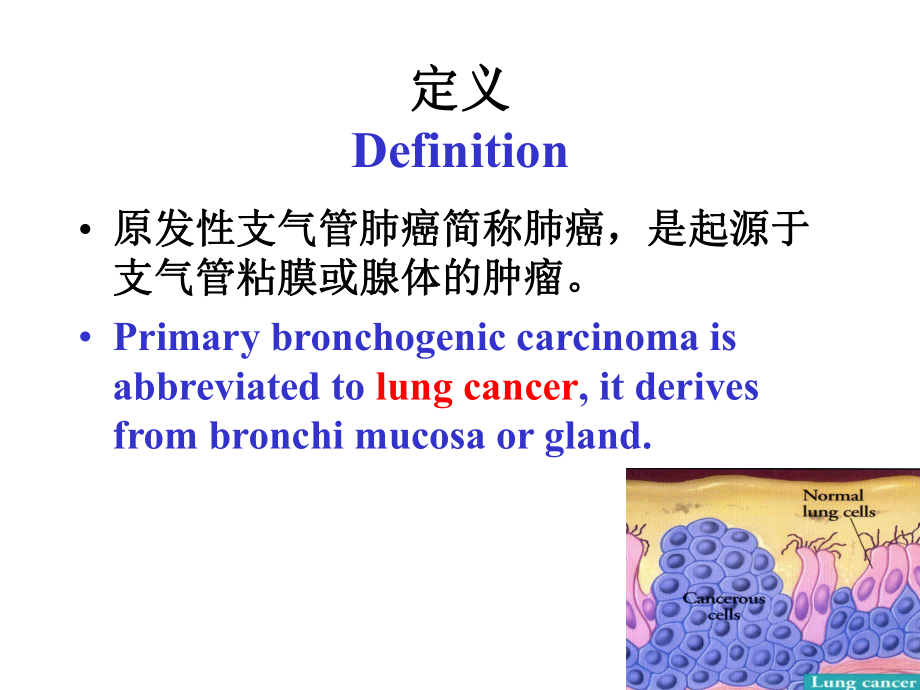 内科呼吸课件：原发性支气管肺癌.ppt_第2页