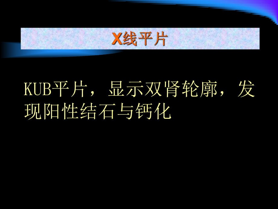 泌尿系统疾病 2.ppt_第3页