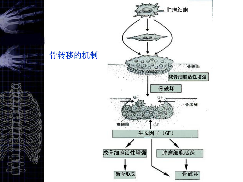 （核医学）第12章骨显像.ppt_第3页