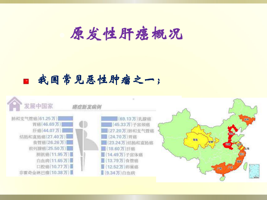 消化系统外科学课件：原发性肝癌外科治疗.ppt_第2页