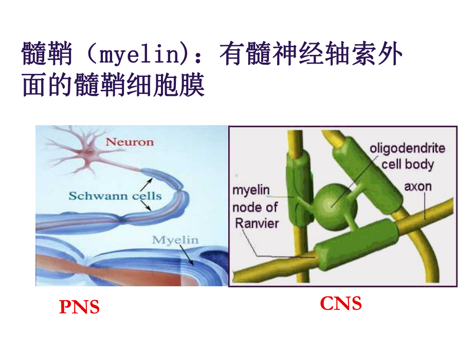 神经病学课件：第11章 中枢性脱髓鞘性疾病.ppt_第3页