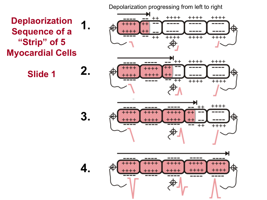 循环系统内科学心律失常-英文教学课件：Cardiac Vector Axis.ppt_第2页