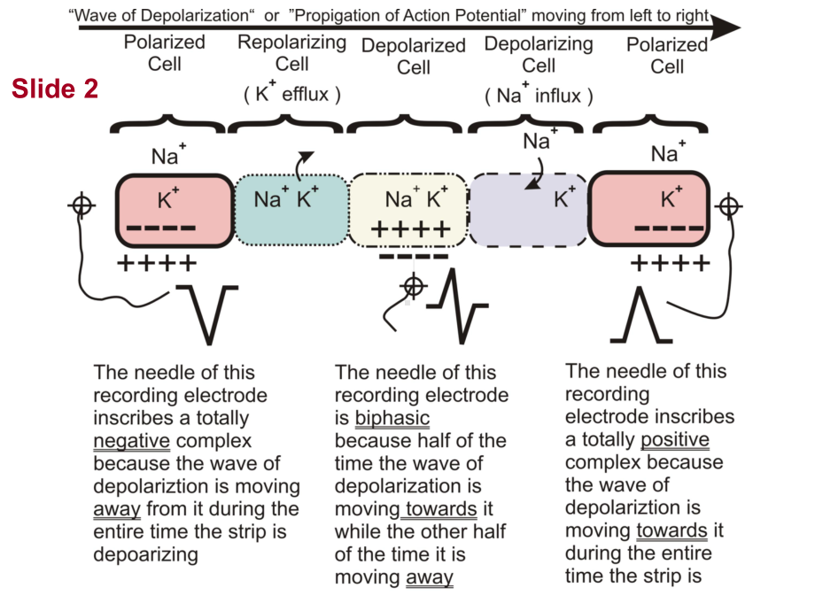 循环系统内科学心律失常-英文教学课件：Cardiac Vector Axis.ppt_第3页