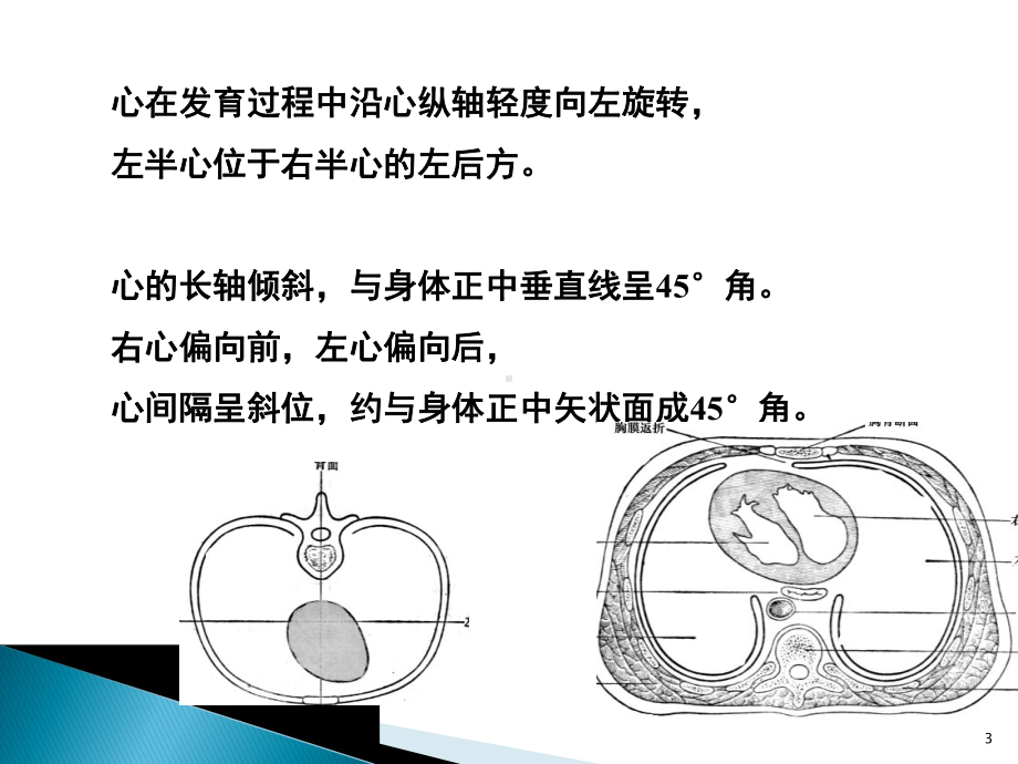 心脏解剖影像和心律失常的导管消融优质PPT课件.pptx_第3页