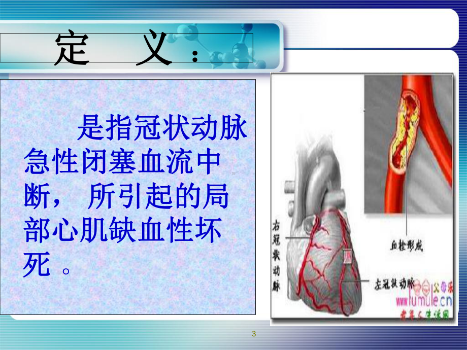 急性心肌梗死抢救配合与护理PPT课件.ppt_第3页