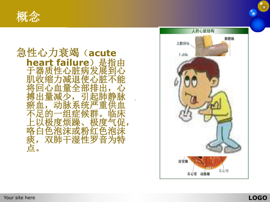 急性左心衰的护理查房PPT培训课件.ppt_第3页