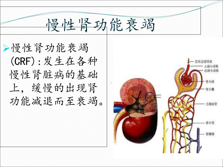 慢性肾功能衰竭护理查房ppt培训课件.ppt_第2页