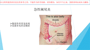 急性阑尾炎专题知识宣讲培训课件.ppt