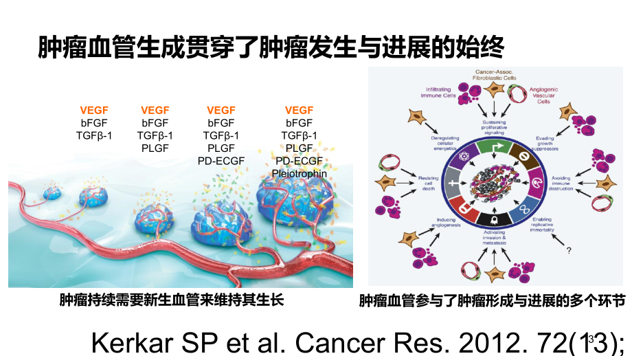 NSCLC的抗血管生成治疗主题讲座课件(共39张).ppt_第3页