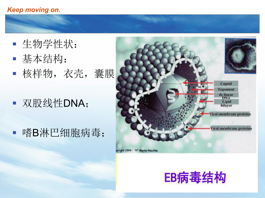 EB病毒感染和传染性单核细胞增多症主题讲座课件(共24张).ppt_第3页