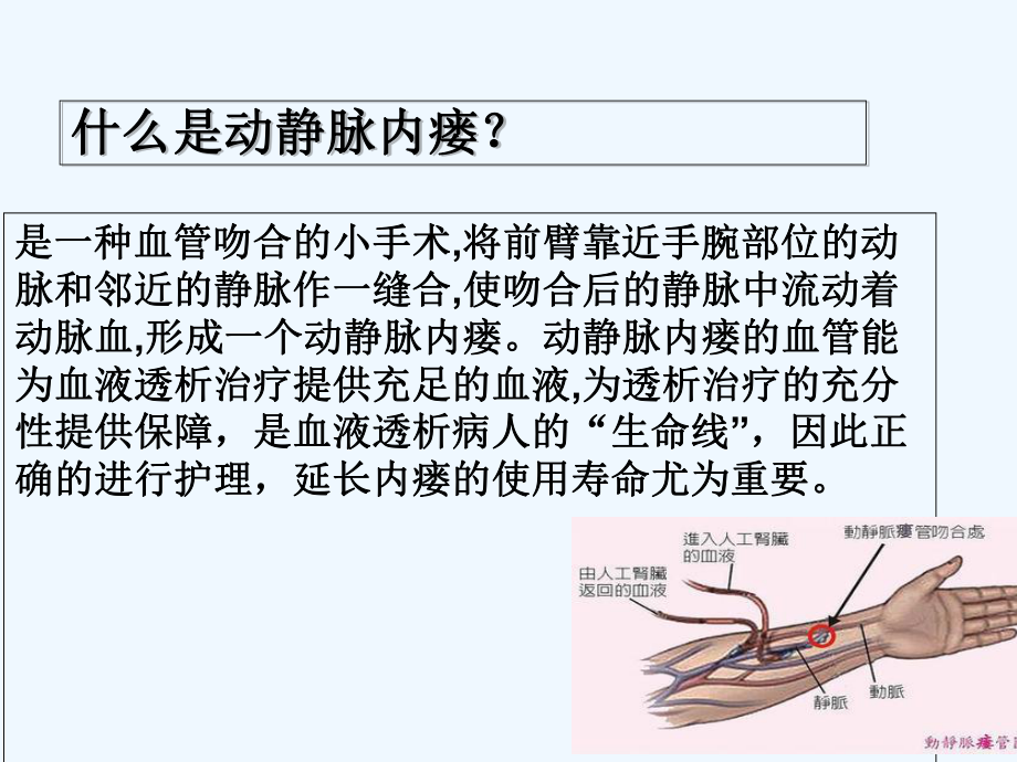 动静脉内瘘的围手术期护理-PPT课件.ppt_第3页