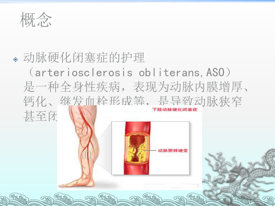 动脉硬化闭塞症的护理ppt课件.ppt_第3页