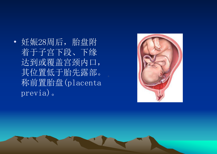 前置胎盘教学查房课件.ppt_第2页