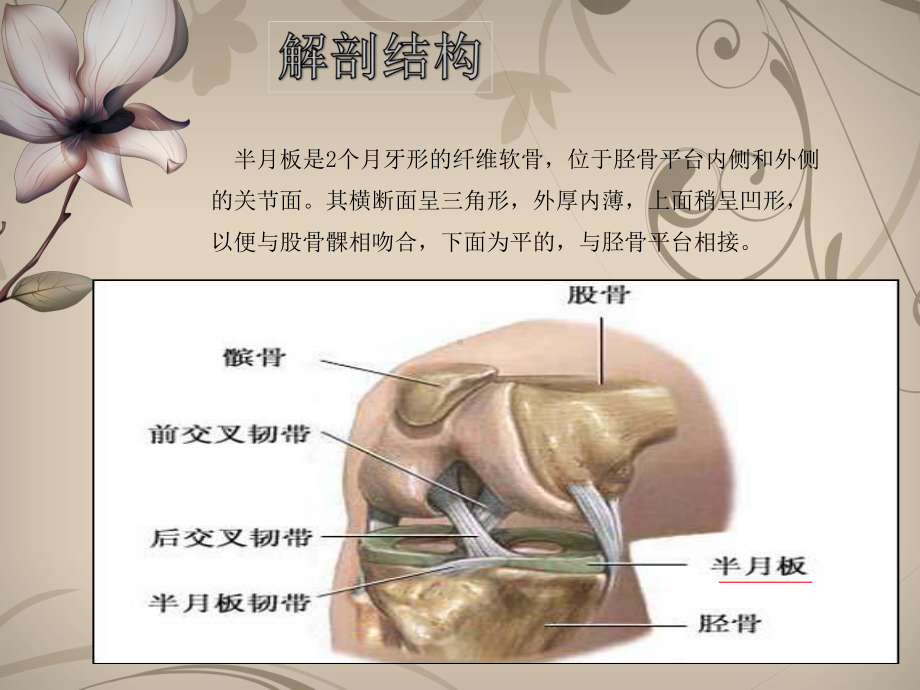 半月板损伤护理PPT课件.pptx_第3页