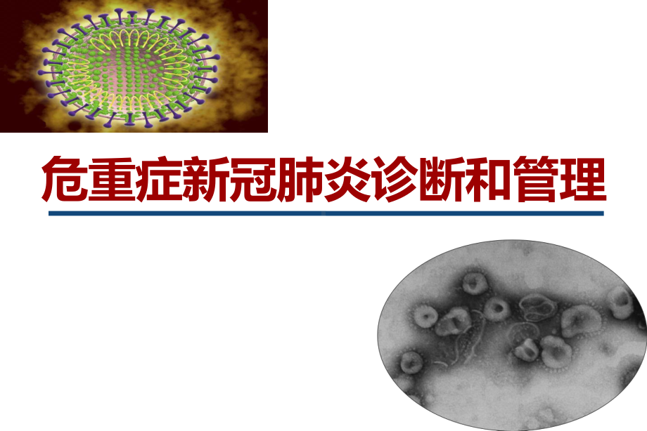 危重症新冠肺炎的临床管理课件.pptx_第1页