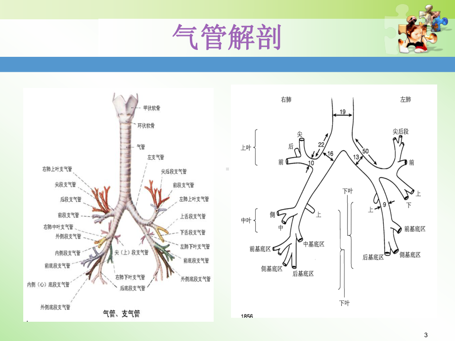 双腔支气管导管定位ppt课件.ppt_第3页