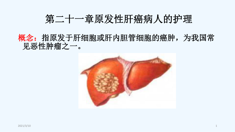 原发性肝癌病人的护理课件.pptx_第1页