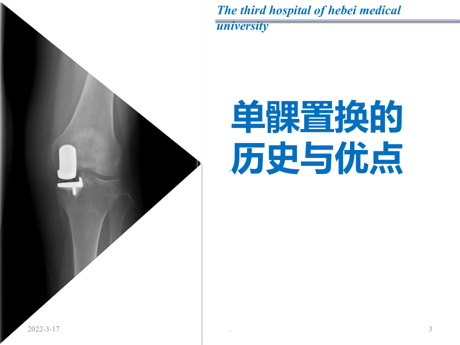 单髁置换PPT课件.ppt_第3页