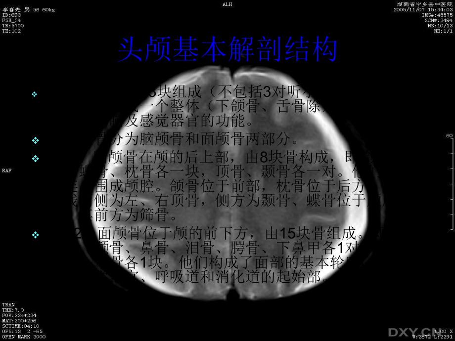 头颅解剖结构及常见病变课件.ppt_第2页