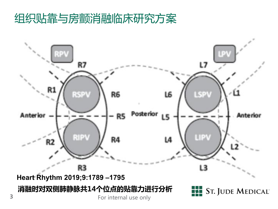 可调弯鞘贴靠强度效果-图文共46页课件.ppt_第3页