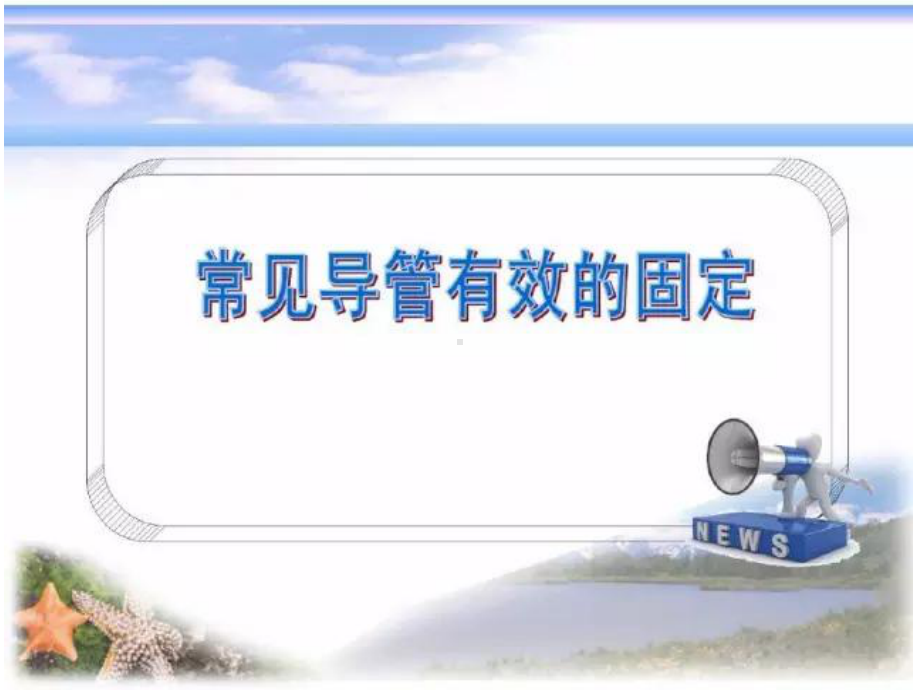 各种导管固定ppt课件.ppt_第1页