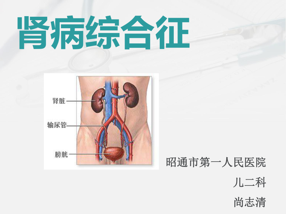 小儿肾病综合征完整版本课件.ppt_第2页