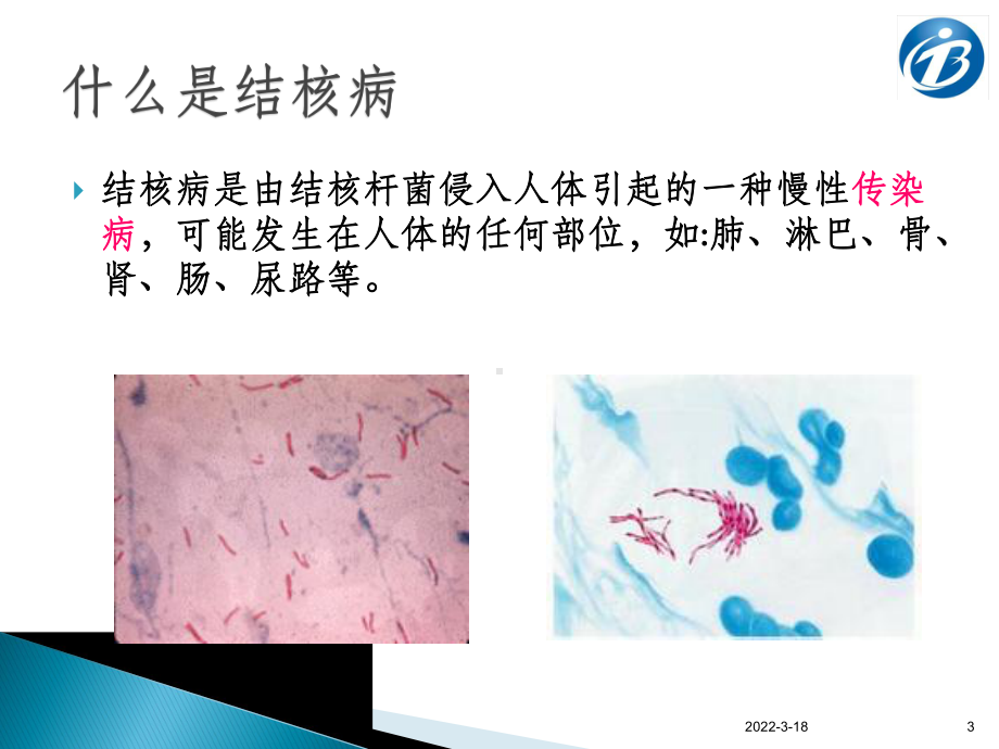 学校结核病防控知识(学生篇)PPT课件.ppt_第3页