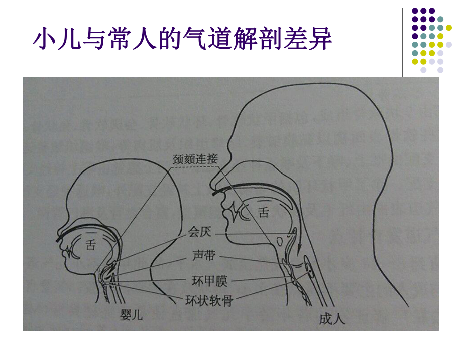 小儿高级气道管理PPT课件.ppt_第2页