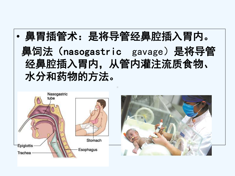 小儿胃管置入术-PPT课件.ppt_第2页