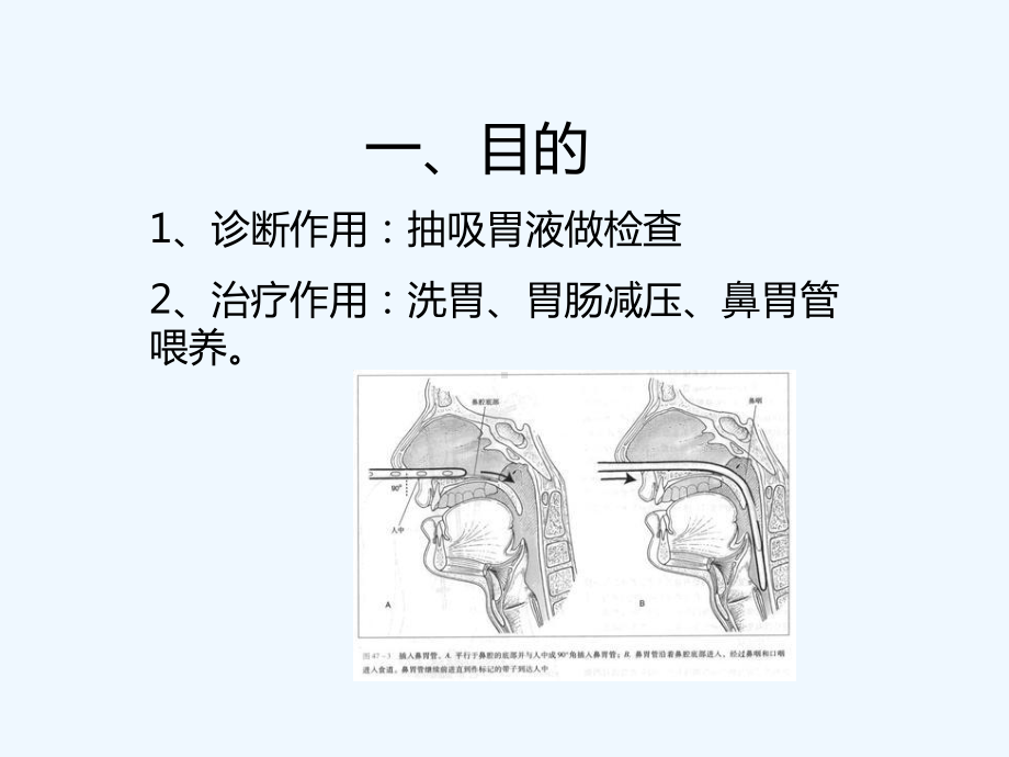 小儿胃管置入术-PPT课件.ppt_第3页